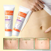 Maternity Stretch Marks Repair Cream